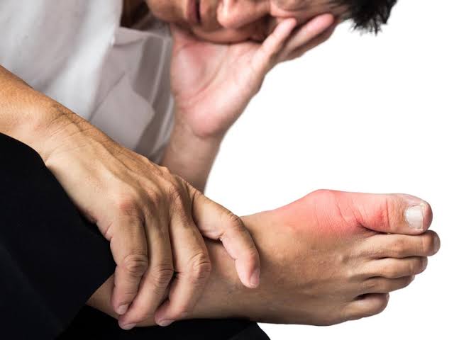 أقوى من المسكنات..دهان سحري لعلاج الروماتويد والذئبة الحمراء